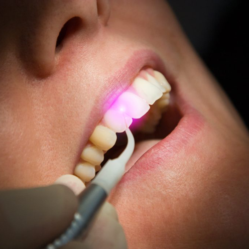 Mediana Dental laser dentistry