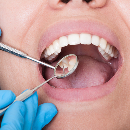Mediana Dental oral higiene